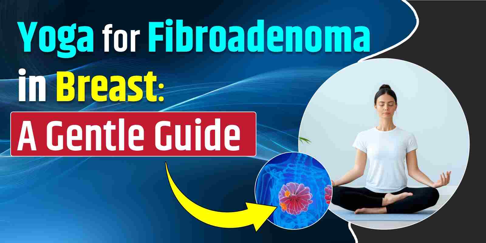Yoga for Fibroadenoma in Breast: A Gentle Guide